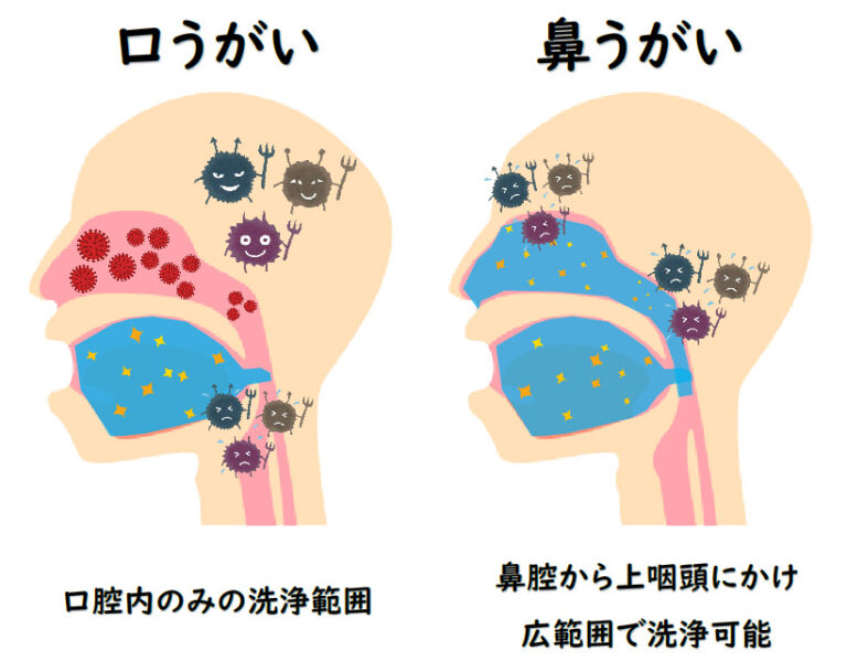 花粉症対策『鼻うがい』100円ショップで代用容器を探してみた 続編 | 町田で肩こり・腰痛治療なら根本改善治療の加藤整骨院